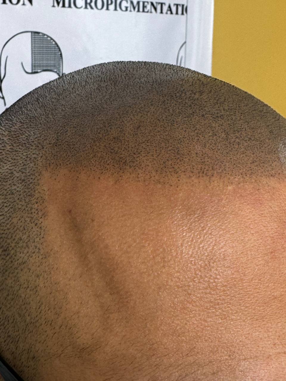 https://microscalpshiraz.com/