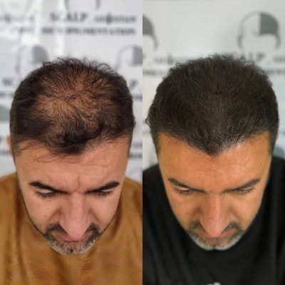 microscalpshiraz.com