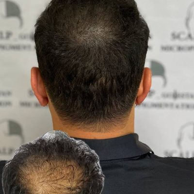 microscalpshiraz.com