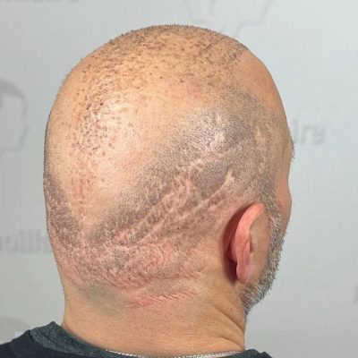 microscalpshiraz.com