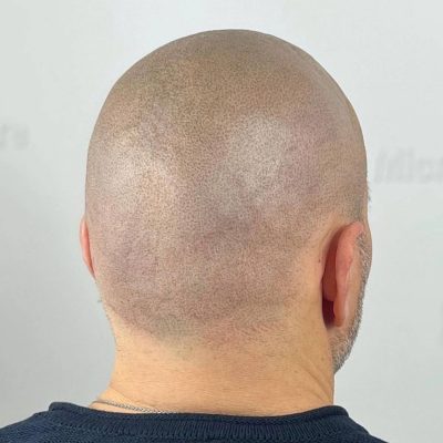 microscalpshiraz.com